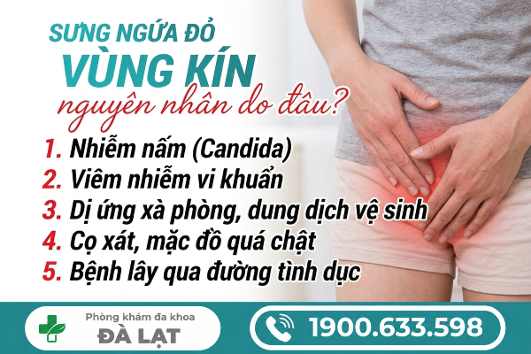 Hình ảnh minh họa